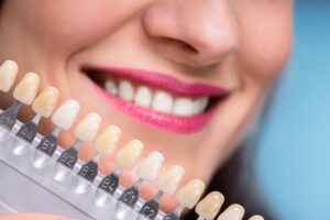 complete dental implants costs sydney