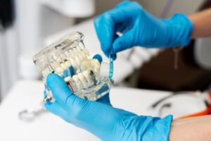 low cost teeth implants sydney